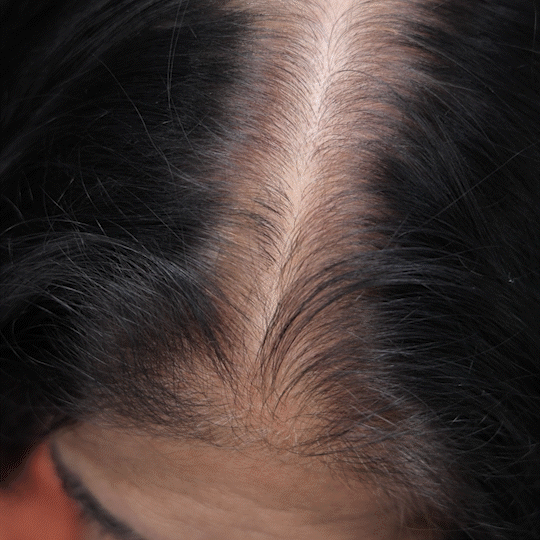 retouch renk kapatıcı