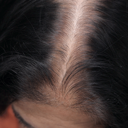 retouch renk kapatıcı